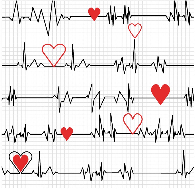 Herzschlag EKG hell - Calling al Nurses