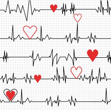 Herzschlag EKG hell - Calling al Nurses